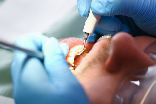 Best Emergency Dental Care for Trauma or Injury in Portage, MI